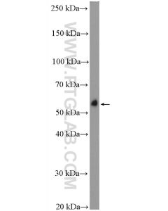 C9orf72 Polyclonal antibody proteintech 22637-1-AP