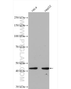 FBXO22 Polyclonal antibody proteintech 13606-1-AP