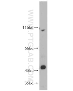 ZIP8 Polyclonal antibody proteintech 20459-1-AP