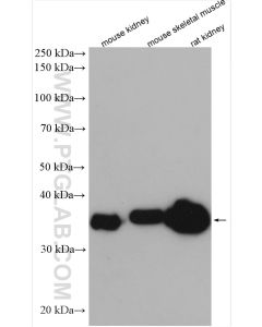 ALDOB Polyclonal antibody proteintech 18065-1-AP