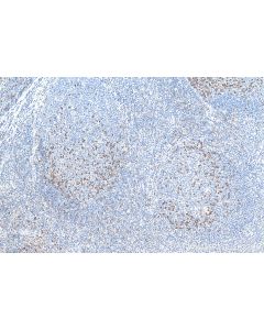 PD-1/CD279 Polyclonal antibody proteintech 18106-1-AP