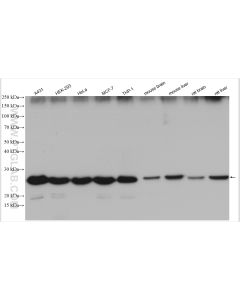 BAP31 Polyclonal antibody proteintech 11200-1-AP