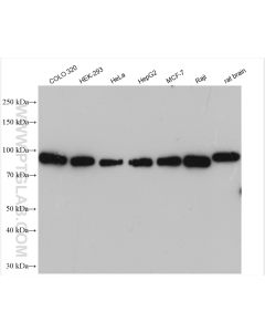 IMMT Polyclonal antibody proteintech 10179-1-AP