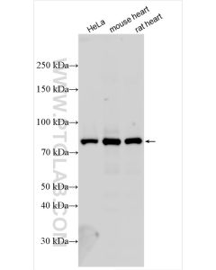 PFKM Polyclonal antibody proteintech 55028-1-AP