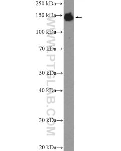 XDH Polyclonal antibody proteintech 55156-1-AP