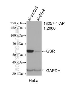 GSR Polyclonal antibody proteintech 18257-1-AP