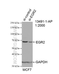 EGR2 Polyclonal antibody proteintech 13491-1-AP