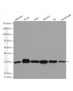 MTAP Polyclonal antibody proteintech 11475-1-AP