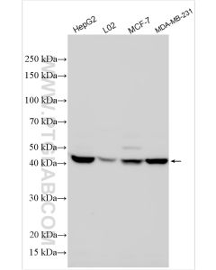 SPHK1 Polyclonal antibody proteintech 10670-1-AP