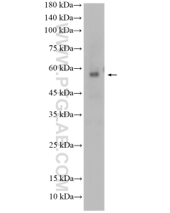 FOXP3 Polyclonal antibody proteintech 22228-1-AP