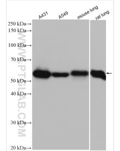 LPCAT1 Polyclonal antibody proteintech 16112-1-AP