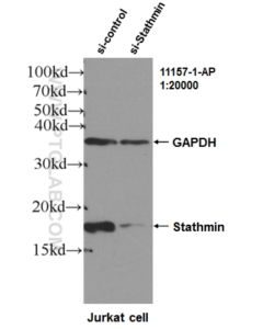 Stathmin 1 Polyclonal antibody proteintech 11157-1-AP