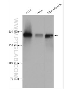 ZEB1 Polyclonal antibody proteintech 21544-1-AP