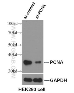 PCNA Polyclonal antibody proteintech 10205-2-AP