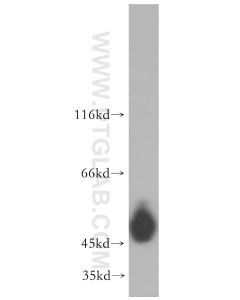 Cytokeratin 14 Polyclonal antibody proteintech 10143-1-AP