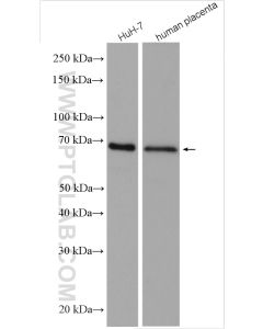 AFP Polyclonal antibody proteintech 14550-1-AP