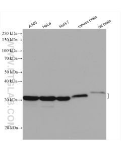 METTL1 Polyclonal antibody proteintech 14994-1-AP