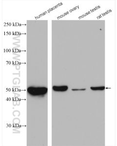 CYP11A1 Polyclonal antibody proteintech 13363-1-AP