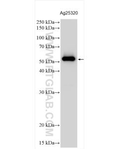 mCherry Polyclonal antibody proteintech 26765-1-AP
