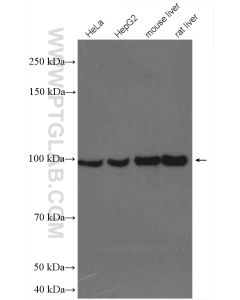 PYGL Polyclonal antibody proteintech 15851-1-AP