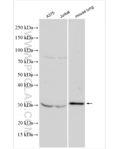 CTHRC1 Polyclonal antibody proteintech 16534-1-AP