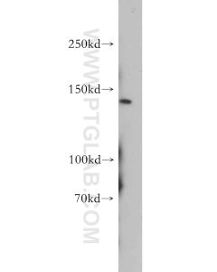 PTCH2 Polyclonal antibody proteintech 55091-1-AP