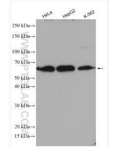 FASTKD2 Polyclonal antibody proteintech 17464-1-AP