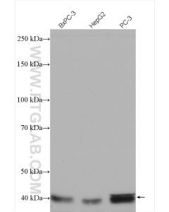 SIRT6 Polyclonal antibody proteintech 13572-1-AP