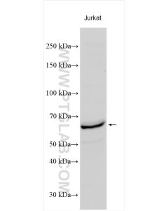CDC6 Polyclonal antibody proteintech 11640-1-AP