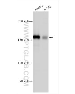 INF2 Polyclonal antibody proteintech 20466-1-AP