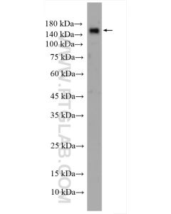 EMR1 Polyclonal antibody proteintech 27044-1-AP