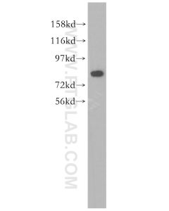 CUX1 Polyclonal antibody proteintech 11733-1-AP