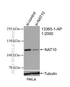 NAT10 Polyclonal antibody proteintech 13365-1-AP