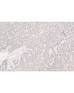 CXCL12/SDF-1 Polyclonal antibody proteintech 17402-1-AP