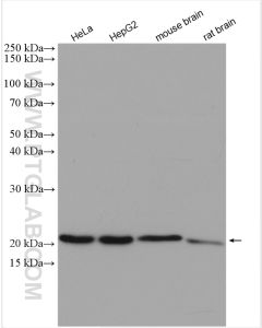 COMMD1 Polyclonal antibody proteintech 11938-1-AP