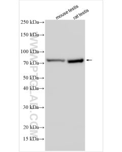 CD2AP Polyclonal antibody proteintech 32089-1-AP
