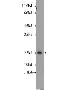RAB27B Polyclonal antibody proteintech 13412-1-AP
