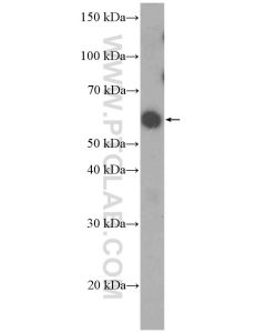 PAX7 Polyclonal antibody proteintech 20570-1-AP
