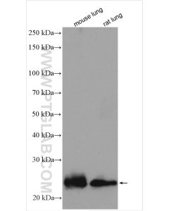 AQP5 Polyclonal antibody proteintech 20334-1-AP