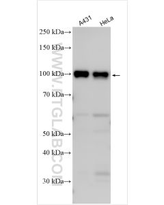 IGFN1 Polyclonal antibody proteintech 25095-1-AP