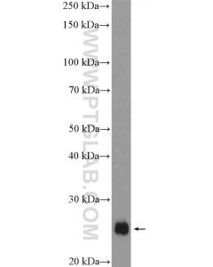 SNAP23 Polyclonal antibody proteintech 10825-1-AP