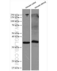Calponin Polyclonal antibody proteintech 13938-1-AP