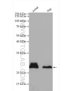 MGMT Polyclonal antibody proteintech 17195-1-AP
