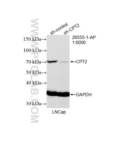CPT2 Polyclonal antibody proteintech 26555-1-AP
