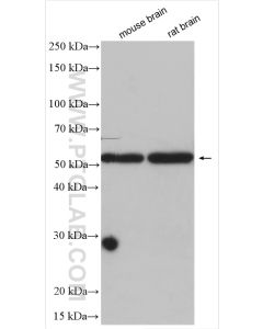 MMP12 Polyclonal antibody proteintech 22989-1-AP