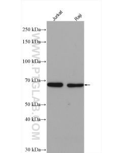 YTHDF2 Polyclonal antibody proteintech 24744-1-AP