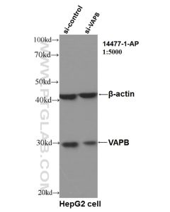 VAPB Polyclonal antibody proteintech 14477-1-AP