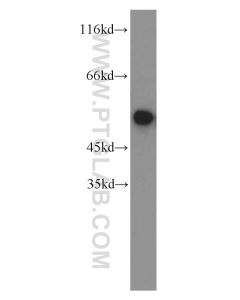 FKBP5 Polyclonal antibody proteintech 14155-1-AP