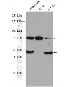 BACE1 Polyclonal antibody proteintech 12807-1-AP