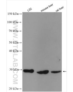 NNMT Polyclonal antibody proteintech 15123-1-AP